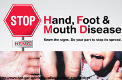 feet with Hand Foot and Mouth Disease Evolve Direct Primary Care Annapolis Anne Arundel County Maryland